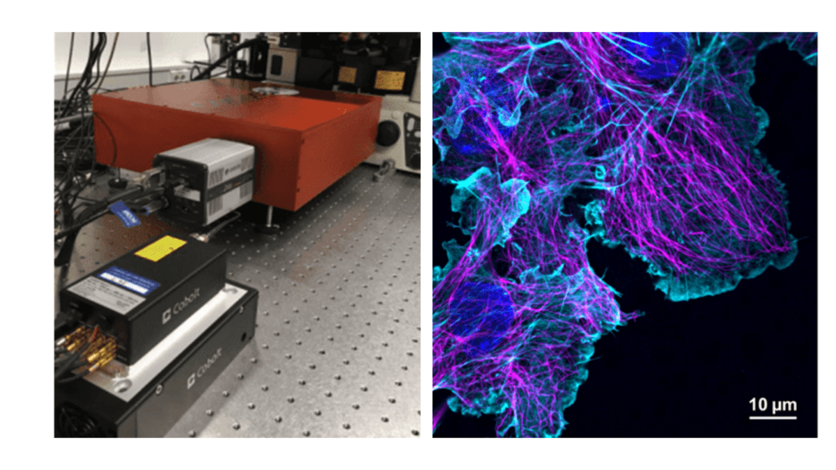 Multi-line lasers simplify fluorescence microscopy - HÜBNER Photonics